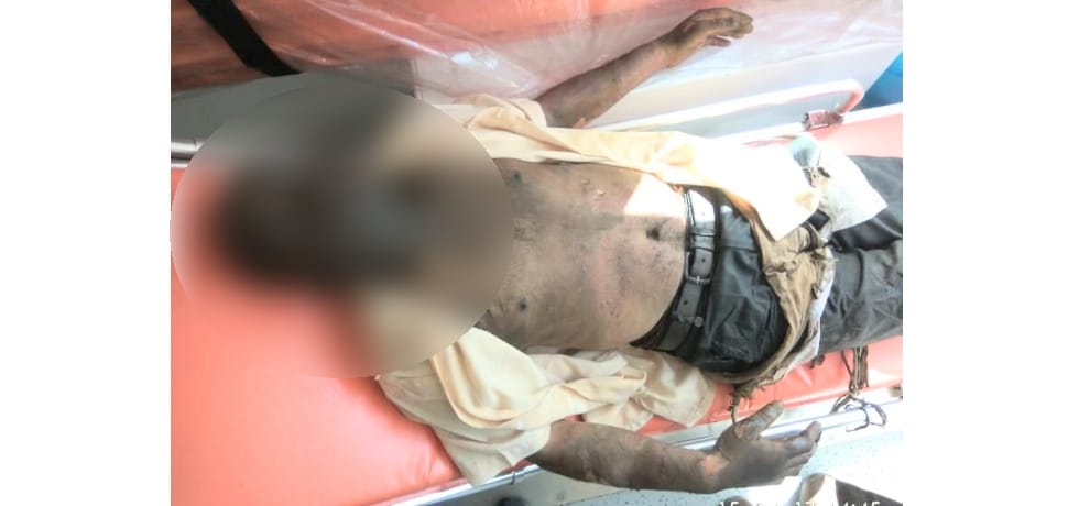 Man attempts self-immolation in Una Himachal Pradesh