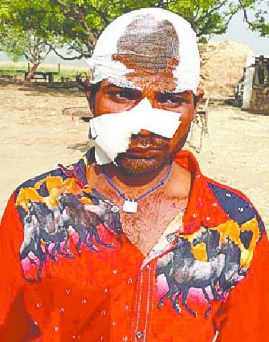 Attack on relatives by calling