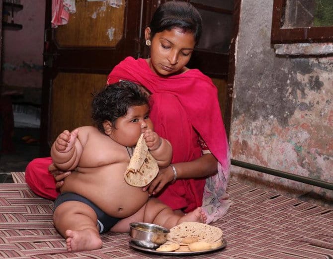 india's heaviest girl child chahat treatment
