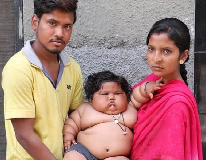 Unique Child, Heaviest Child in India