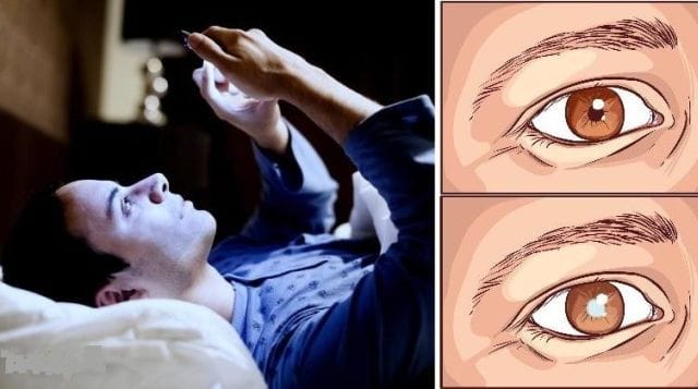 eye