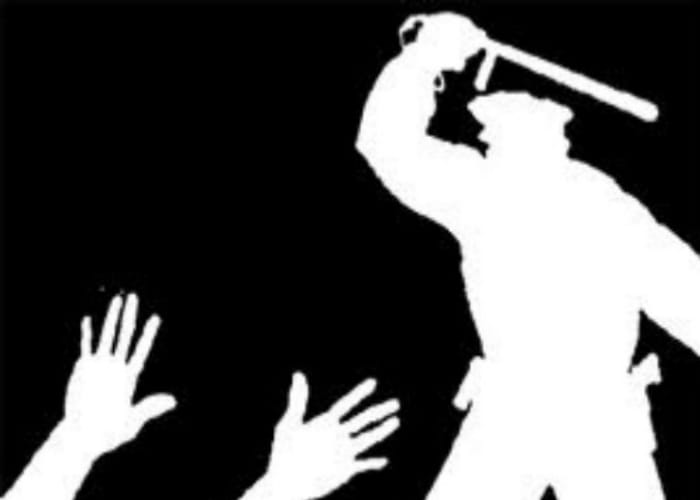 police beats accused father to death in barabanki