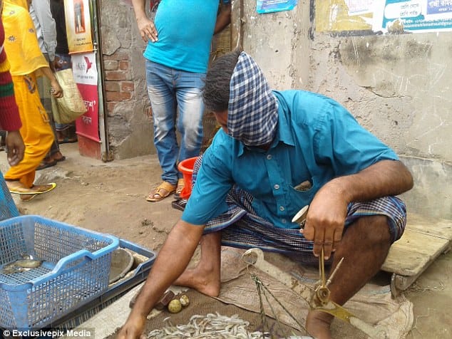 Fisherman whose face was destroyed by a TIGER, he is desperate for plastic surgery