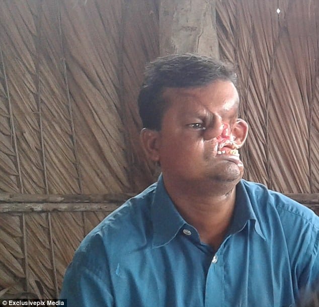 Fisherman whose face was destroyed by a TIGER, he is desperate for plastic surgery