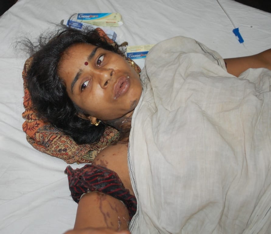 Teaspoon thrown on mother-in-law