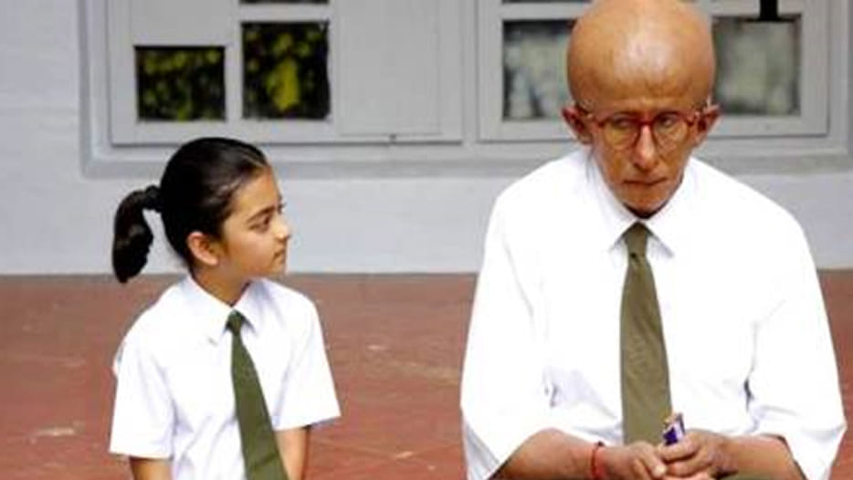 aditya suffering projoriya disease  