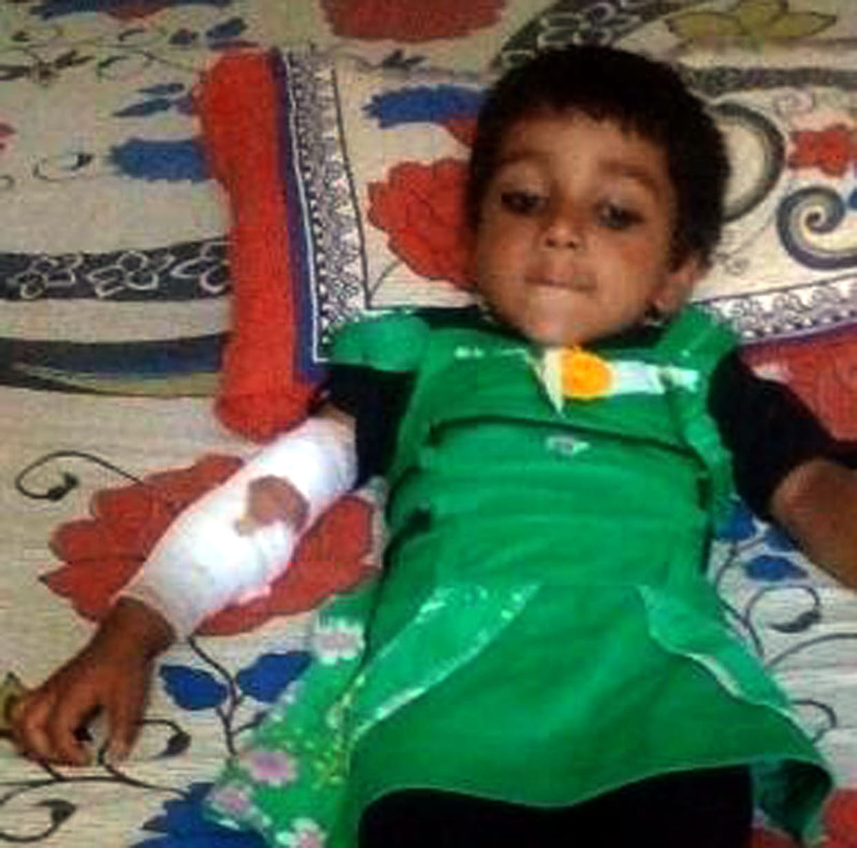 6-year-old girl injured.