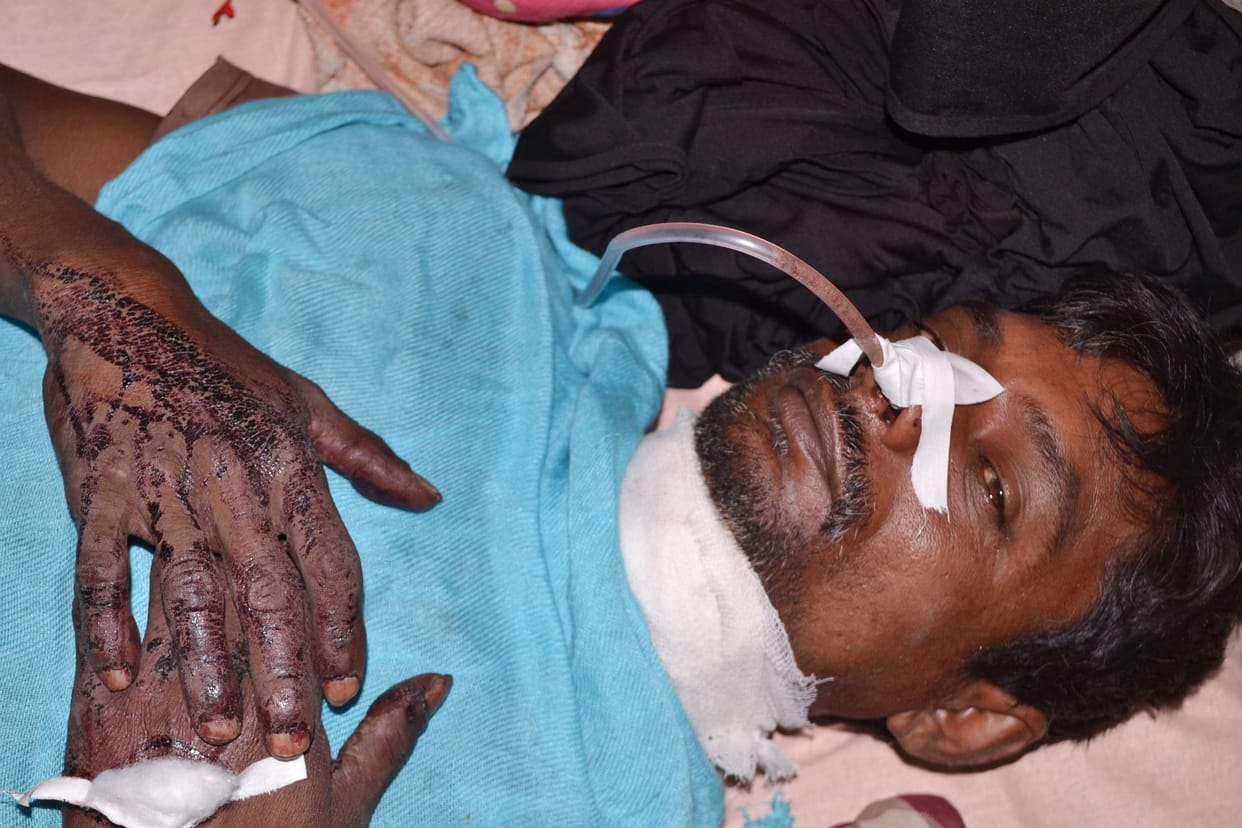 The laborer tried to give life to the throat of his throat