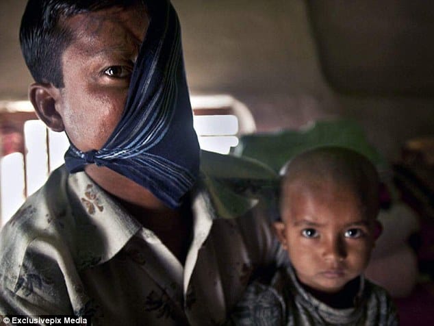 Fisherman whose face was destroyed by a TIGER, he is desperate for plastic surgery
