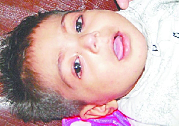 Children in the grip of diarrhea
