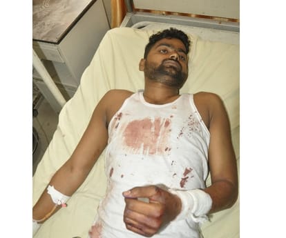  couple attepmted suicide in a hotel in Lucknow.