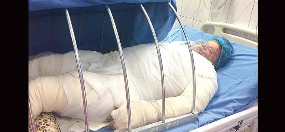 teacher doused in acid attack for dowry crime in ghaziabad