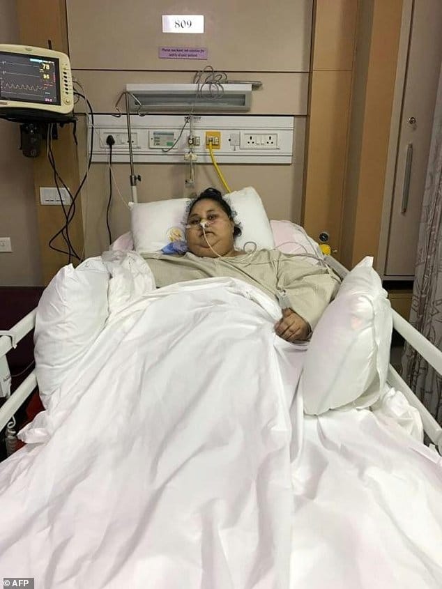 world heaviest women after loosing weight