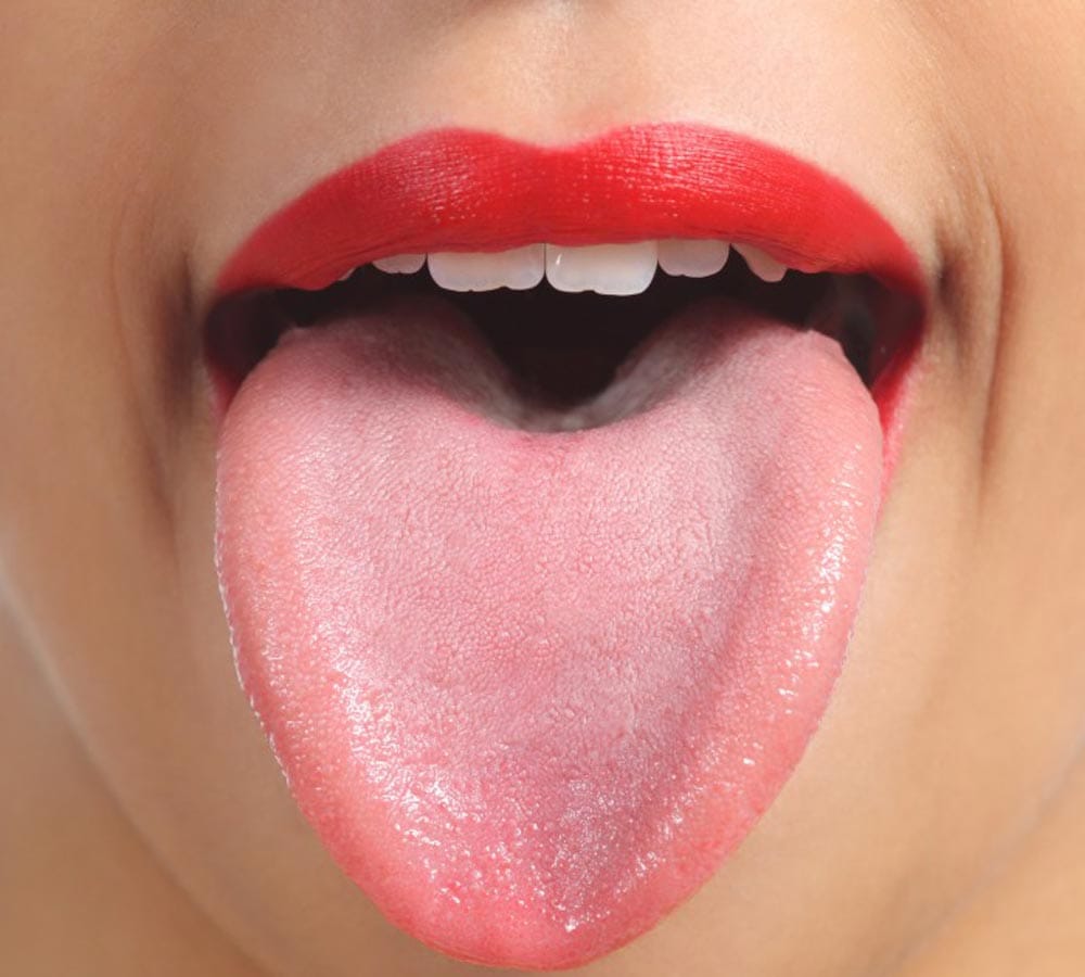 change in tongue colour means, know what expert says about this