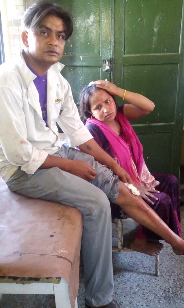 Couple beating the couple in Kashiram colony, police made medical