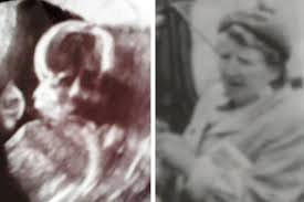 grand mother face in women baby scan