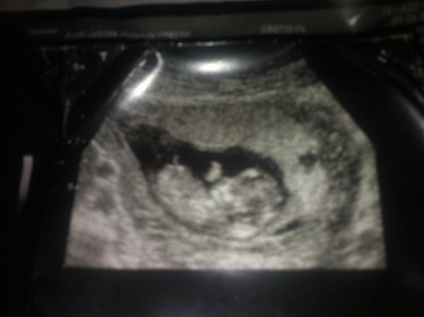grand mother face in women baby scan
