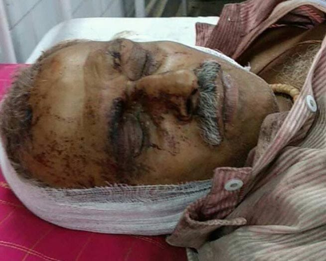 Strike controversy: Attack on two people, two injured