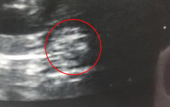 grand mother face in women baby scan