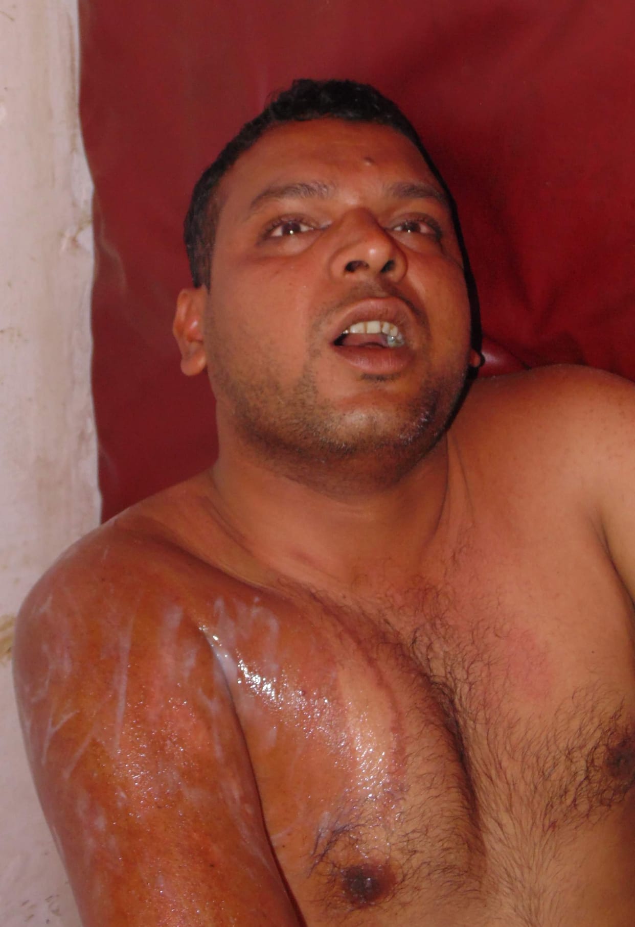 chemical throw at yongman
