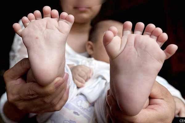 Chinese baby born with 16 toes