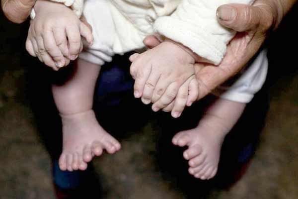 Chinese baby born with 16 toes