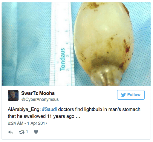 Saudi doctors find bulb inside a guy’s stomach 