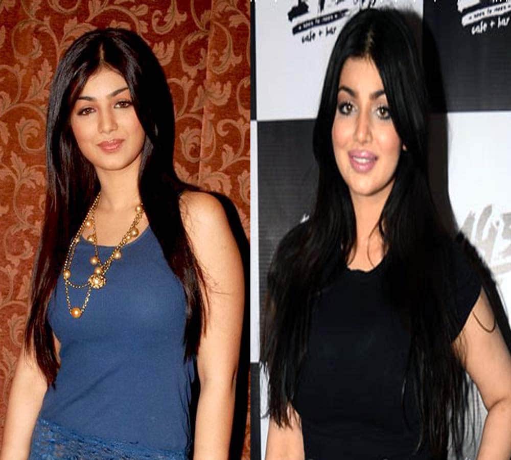Actress Ayesha Takia then and now post surgery, looked beautiful during modelling days