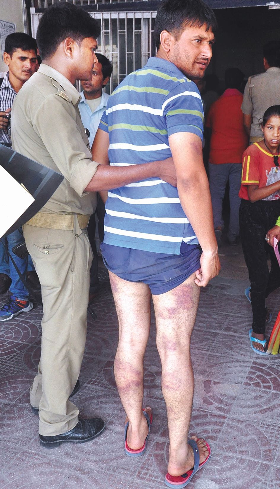 Police medical Was beaten after