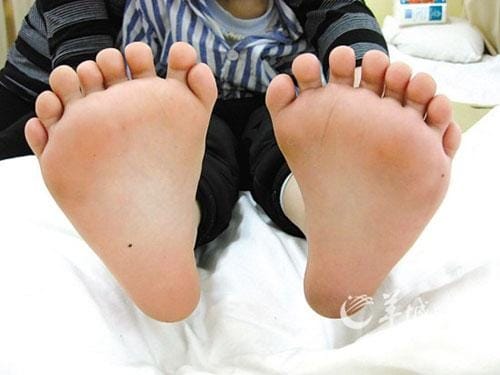 Chinese baby born with 16 toes