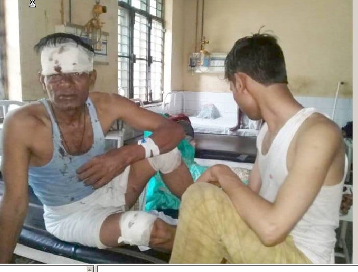 Filled with Baramati in Mujaria Bus reversed, 35 injured