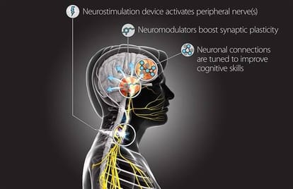 US military is working on a project TNT to build new neural pathways in brain