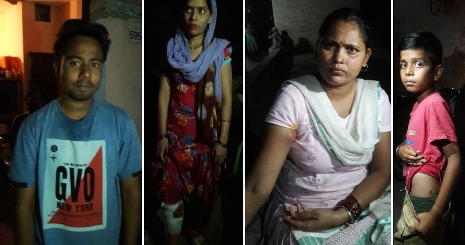 Chandigarh dog bite, city news, protes against dog bite