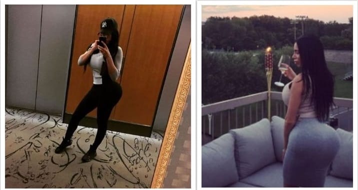 plastic surgery cause death  Kristyna Martelli a model