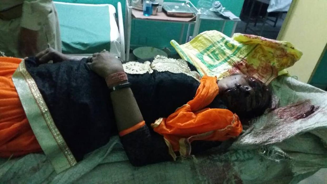 Divyang attacked the sister with shovel.