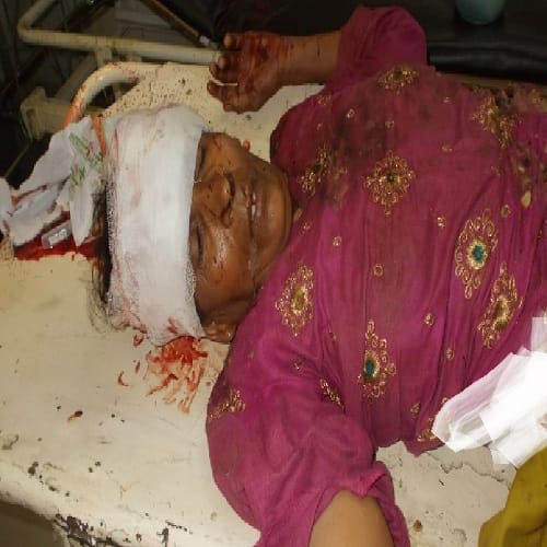 When the wife came to house of Sadhu, husband cut his wife and sister-in-law, you will see pictures