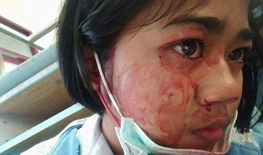 this girl have a headache and blood from her eyes, ears, nose and skin