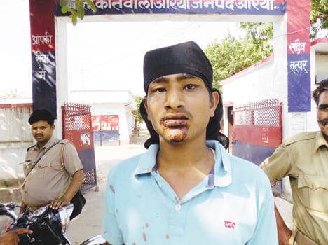 Dabang bricks the young man, injures him