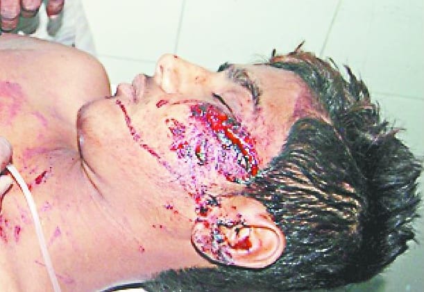 UP peasants beaten by farmers