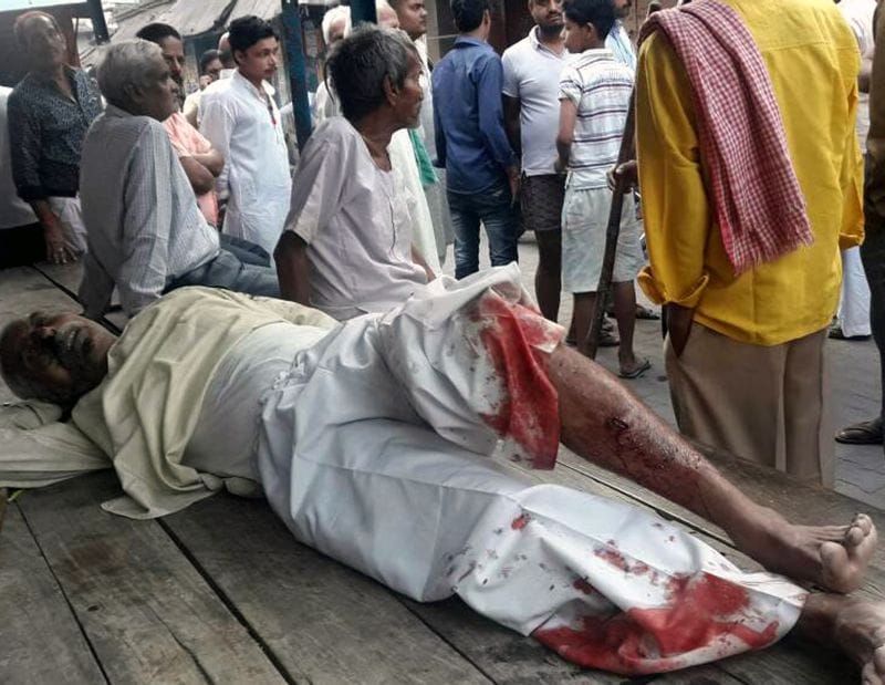 soron mein dinadahaade adhed ko golee maaree