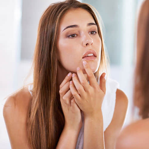 If you want to get rid of the blackheads then these methods at home
