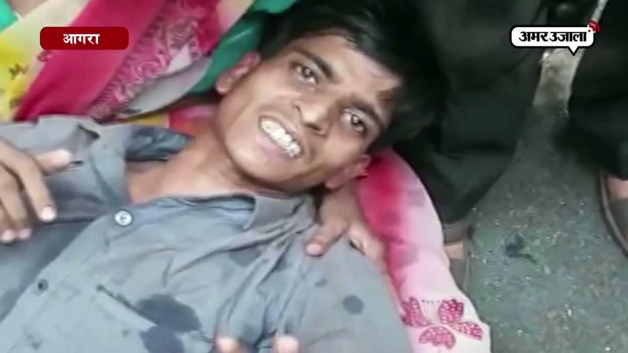 आगरा, सीएम योगी, एन मेडिकल कॉलेज 