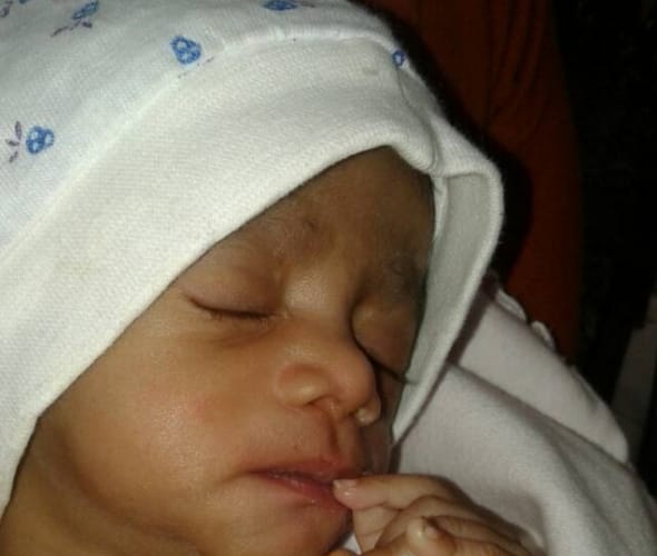 child died from gangrene in rajkiya bal griha shishu in lucknow