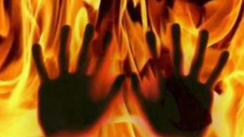 a man burnt alive by his in laws in ajmer 