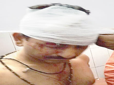 Saraf shot and robbed in Fatehpur