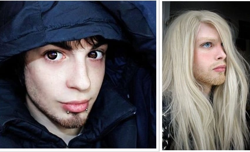 Man spend 25k on surgery to look like an angel 