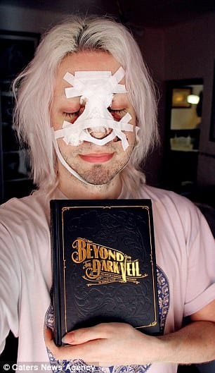 Man spend 25k on surgery to look like an angel 