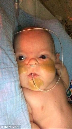 baby born at just 23 weeks with black toe 