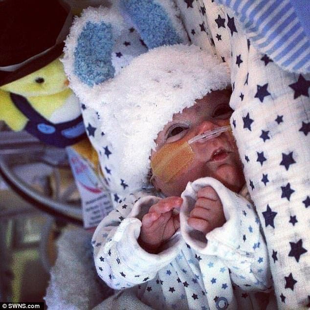 baby born at just 23 weeks with black toe 