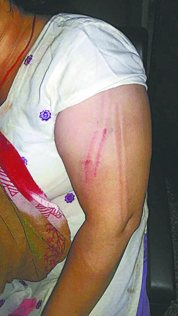 Assault on widow, women, teasing, haryana, rohtak, police
